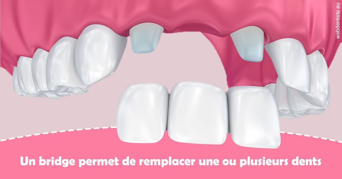 https://dr-hassaneyn-anglais.test-moncomptewebdentiste.fr/Bridge remplacer dents 2