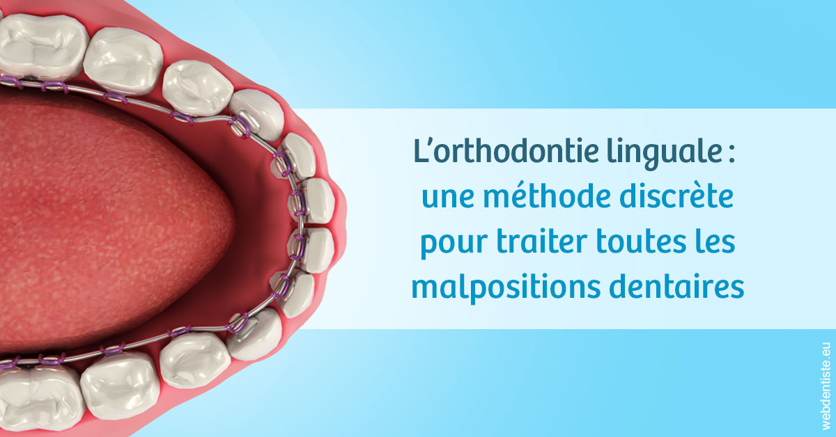 https://dr-hassaneyn-anglais.test-moncomptewebdentiste.fr/L'orthodontie linguale 1