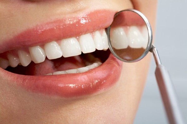 WHAT IS DENTAL STRIPPING ?