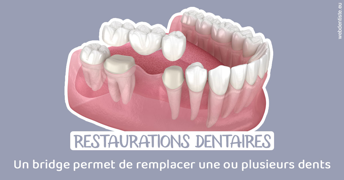 https://dr-hassaneyn-anglais.test-moncomptewebdentiste.fr/Bridge remplacer dents 1