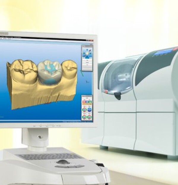 THE RELIABILITY OF THE METHOD CEREC