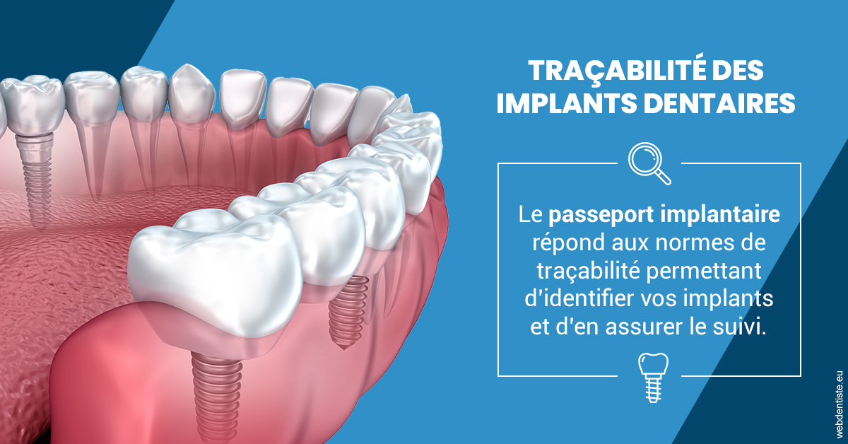 https://dr-hassaneyn-anglais.test-moncomptewebdentiste.fr/T2 2023 - Traçabilité des implants 1