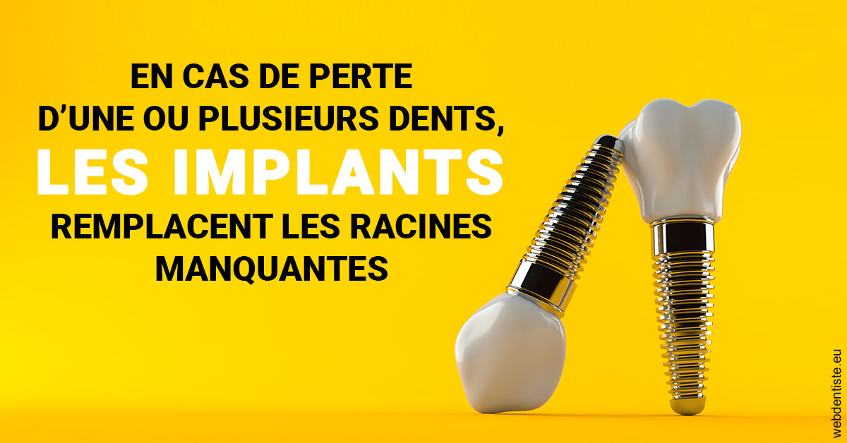 https://dr-hassaneyn-anglais.test-moncomptewebdentiste.fr/Les implants 2