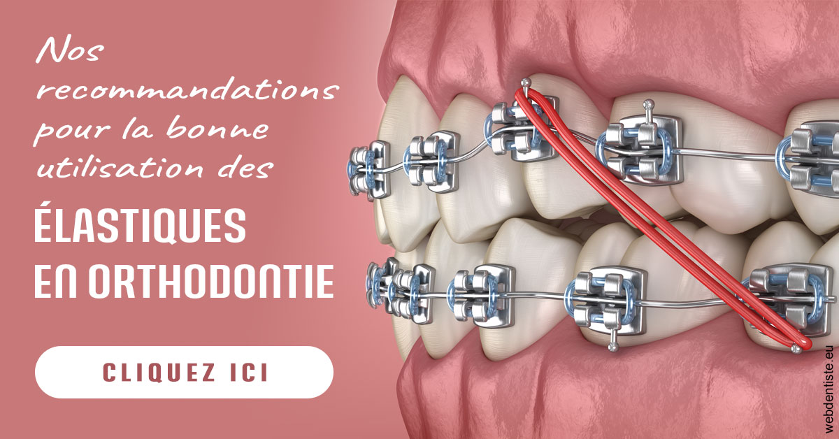 https://dr-hassaneyn-anglais.test-moncomptewebdentiste.fr/Elastiques orthodontie 2