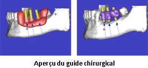 guide-chirurgical(1)