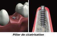 pilier-cicatrisation-c